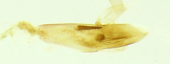 Microcyphus Rousseaui 希少金色 ウニ 殻 Microcyphus Rousseaui 希少金色 ウニ 殻 Microcyphus Rousseaui